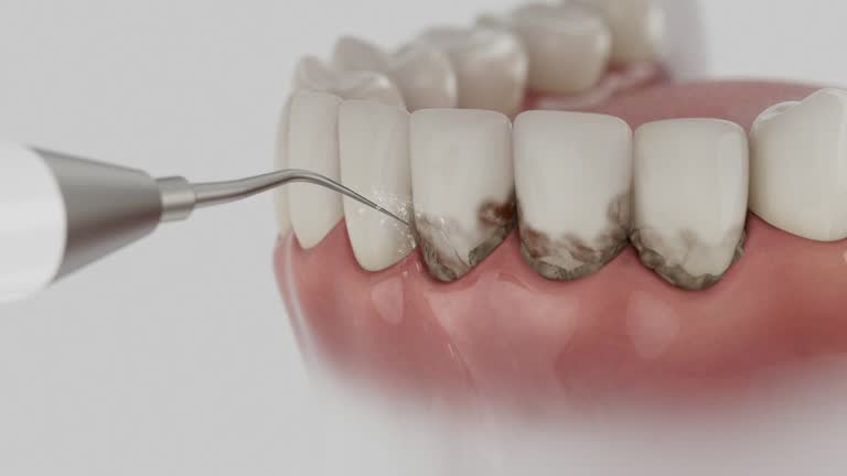 Reliable Tooth Extraction contractor in Ware County County, GA by Dentist Open Now